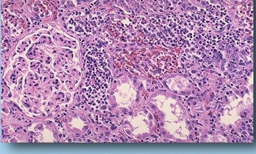 四君子颗粒配方用量、四君子颗粒的搭配用药 -四君子颗粒的中草药分量网